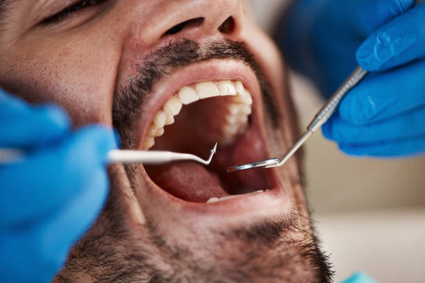 Best Knocked-Out Tooth Emergency  in Soda Springs, ID